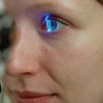 Glaucomul